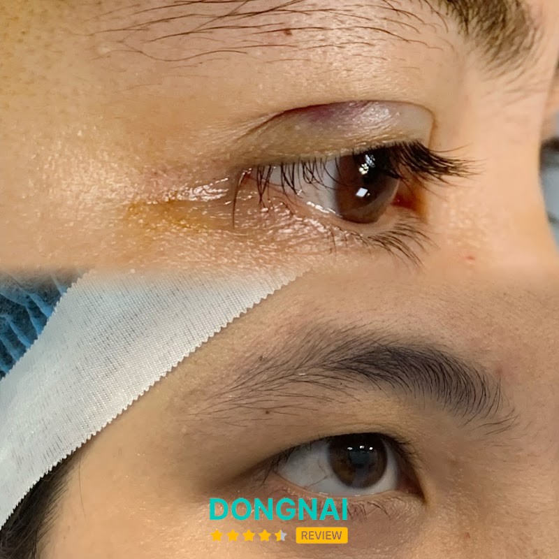 Thẩm Mỹ Viện Bác Sĩ Kim Hà – hình ảnh 3