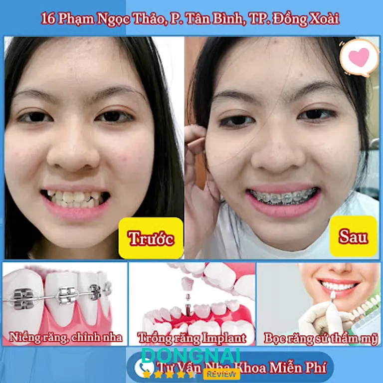 Nha khoa An Tâm: 80 Lý Thường Kiệt, P. Bình Phước