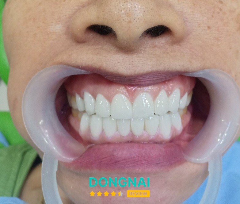 Nha Khoa Tuấn Đức – hình ảnh 2
