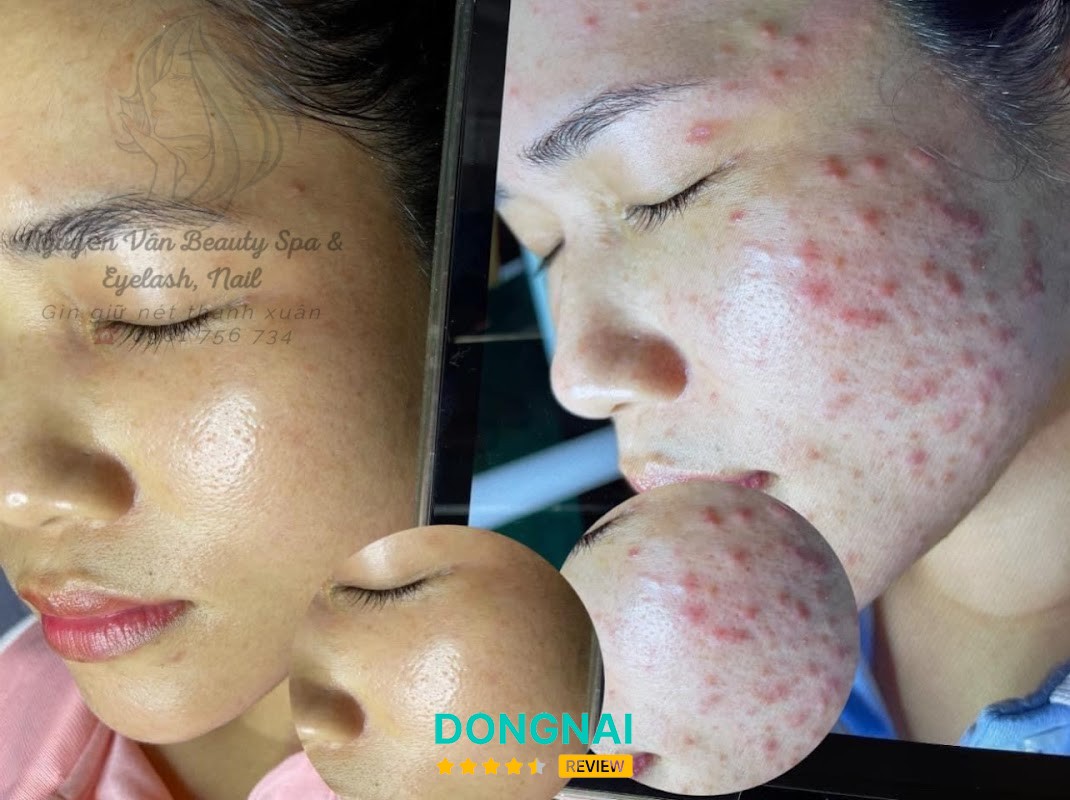 Nguyễn Vân Beauty Spa – hình ảnh 2